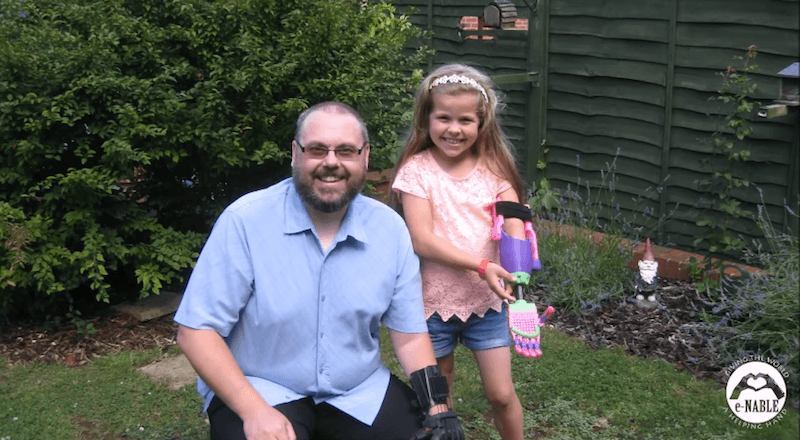 3D yazıcıyla üretilen protez eller hayat değiştirdi