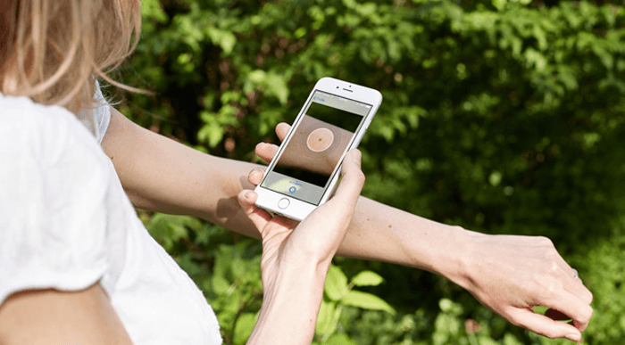 Cilt kanseri riskini ölçen uygulama SkinVision