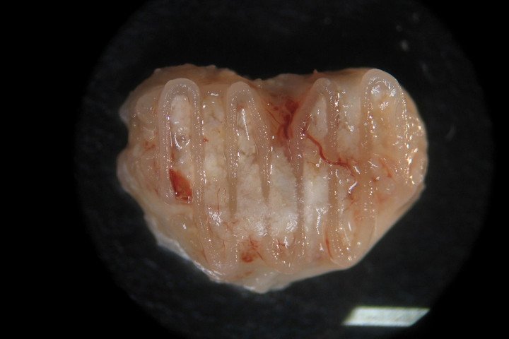 3d-yazici-ile-kemik-u%cc%88retmek