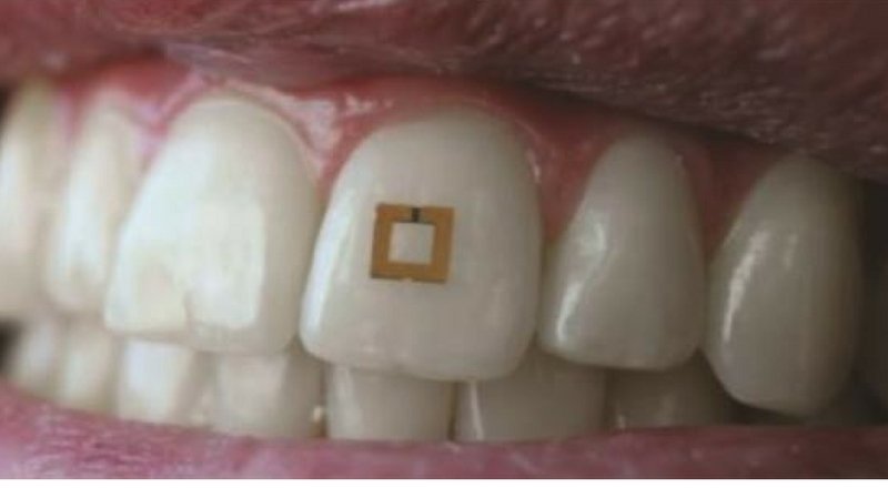Diş yüzeyine yerleştirilen minik sensörler ile diyet takibi dönemi başlıyor