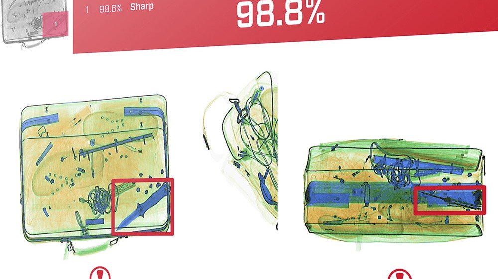 X-ray cihazlarına yapay zeka kabiliyeti getiren Synapse 6 milyon dolar yatırım aldı