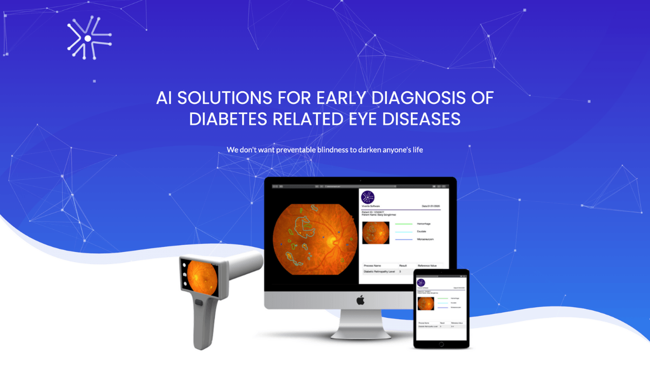 Diyabet kaynaklı göz hastalıklarının erken teşhisi için yapay zeka tabanlı çözümler sunan girişim: Vivente
