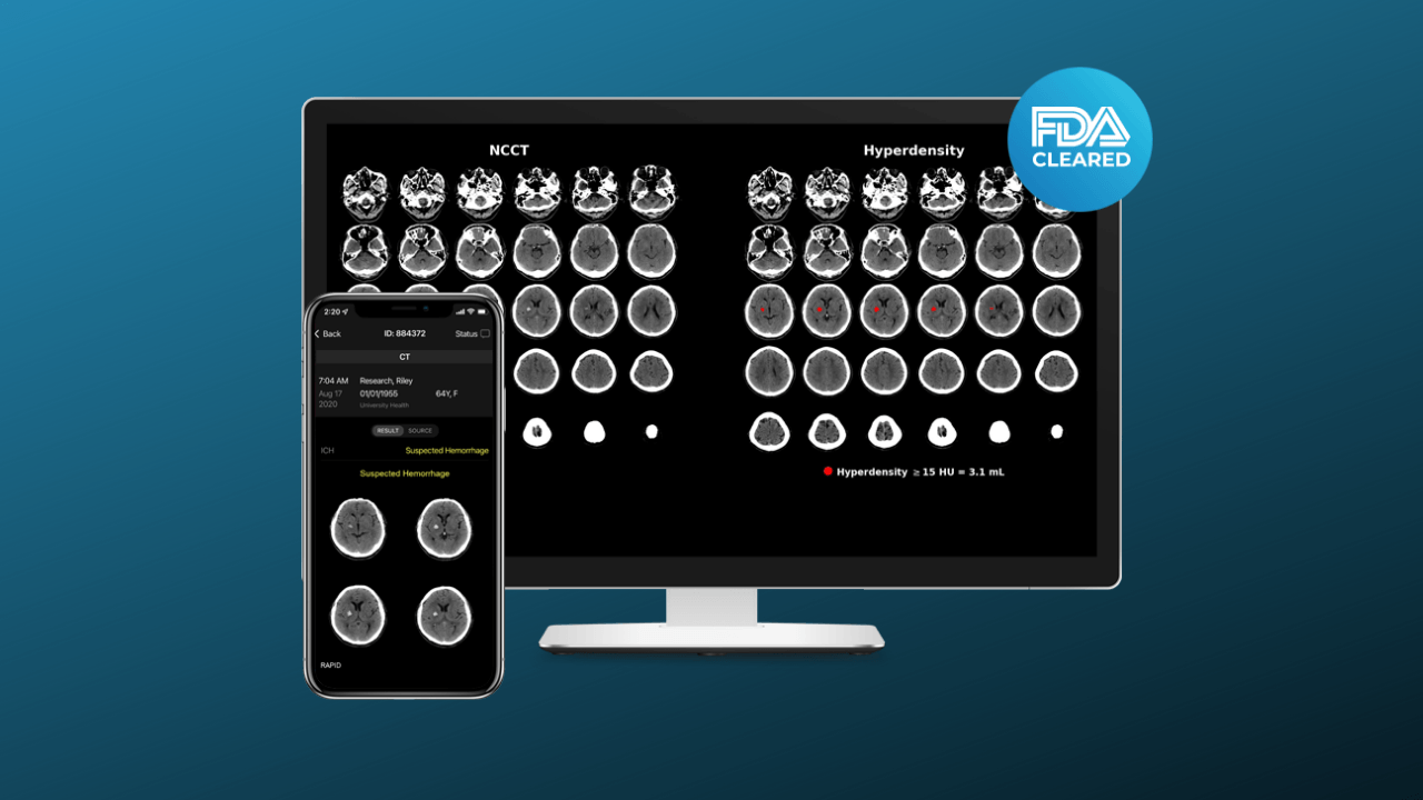 Tıbbi görüntü işleme platformu RapidAI, 75 milyon dolar yatırım aldı