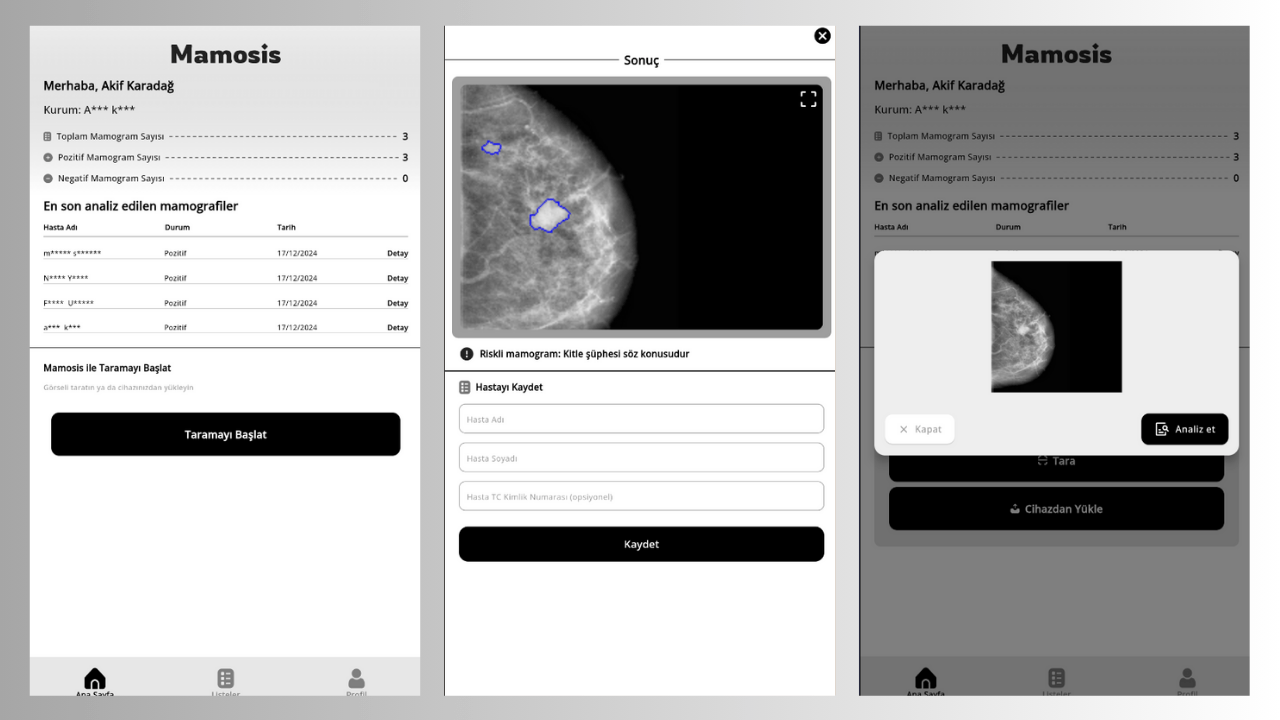 Meme kanserinin erken teşhisi için geliştirilen yerli yapay zeka çözümü: Mamosis